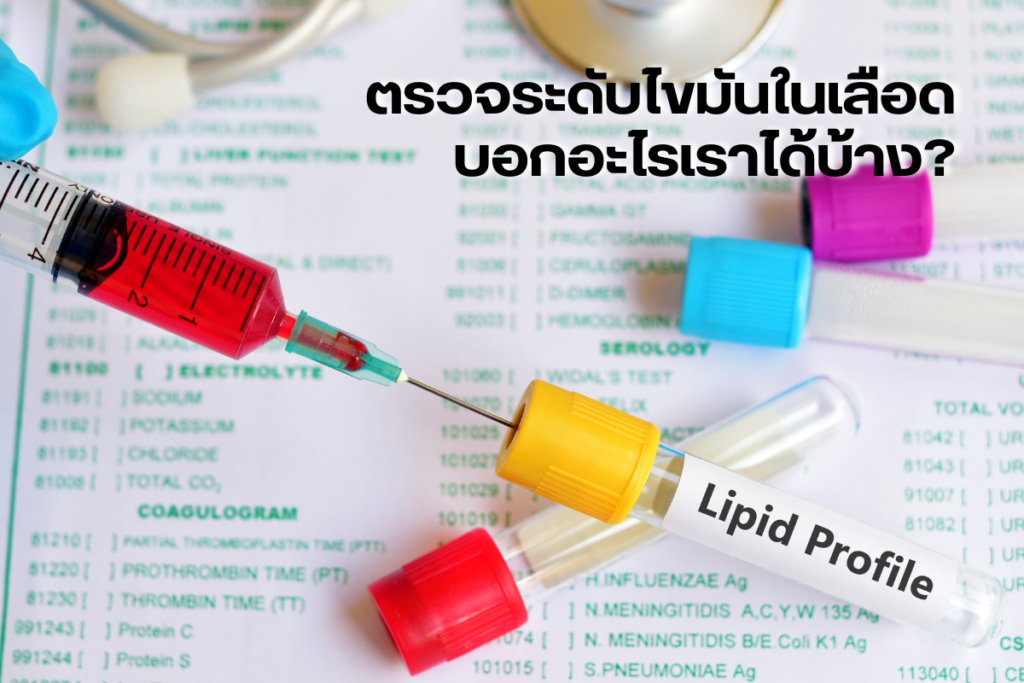 ตรวจระดับไขมันในเลือด