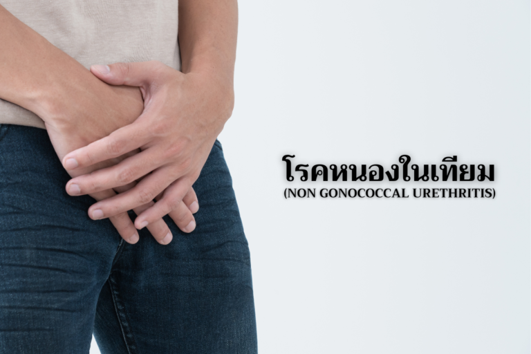 โรคหนองในเทียม