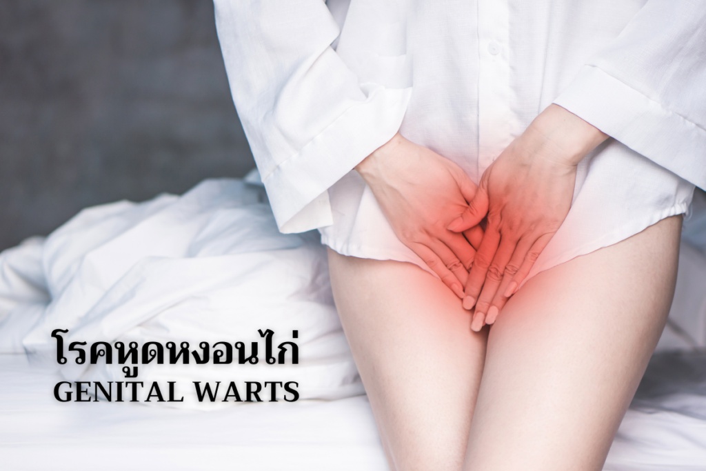 โรคหูดหงอนไก่