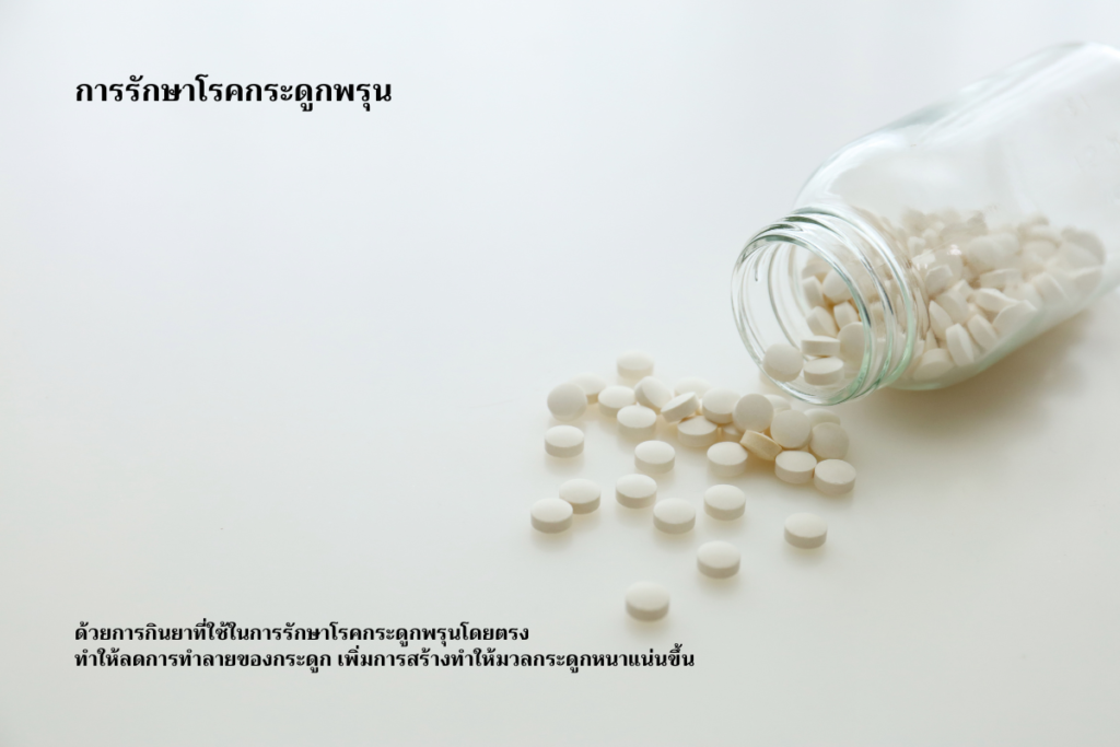 การรักษาโรคกระดูกพรุน