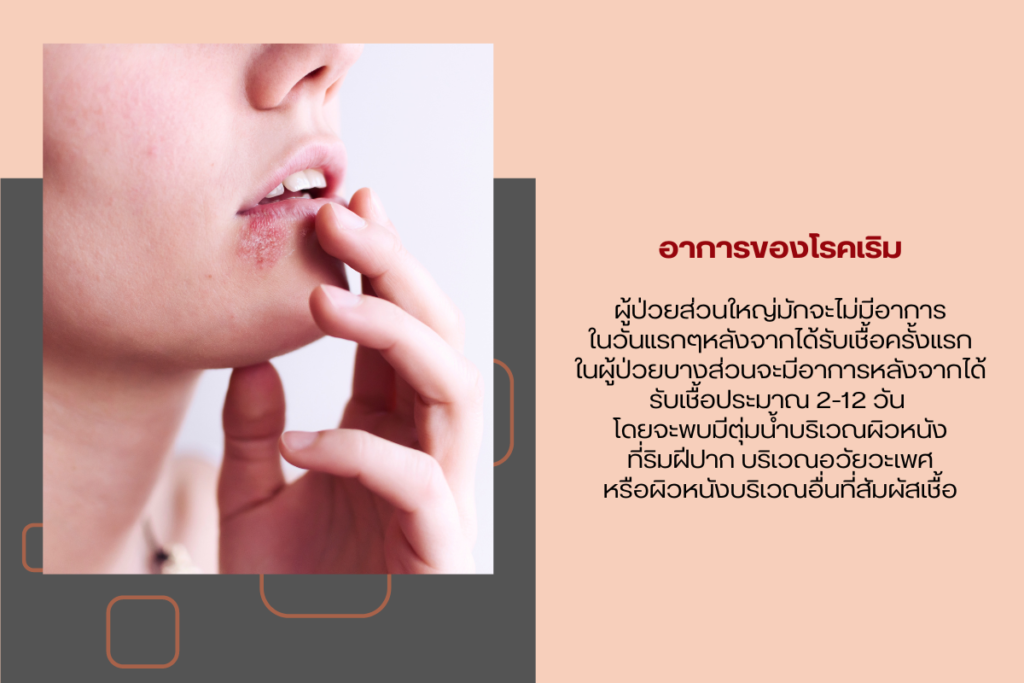 อาการของโรคเริม