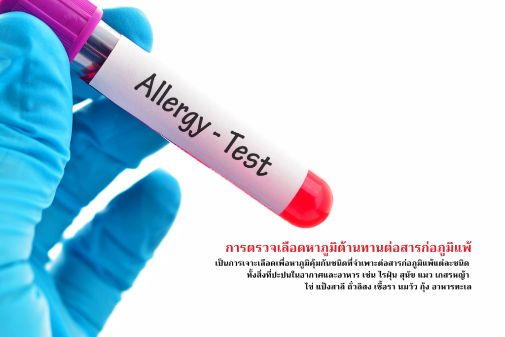 การตรวจเลือดหาภูมิต้านทานต่อสารก่อภูมิแพ้