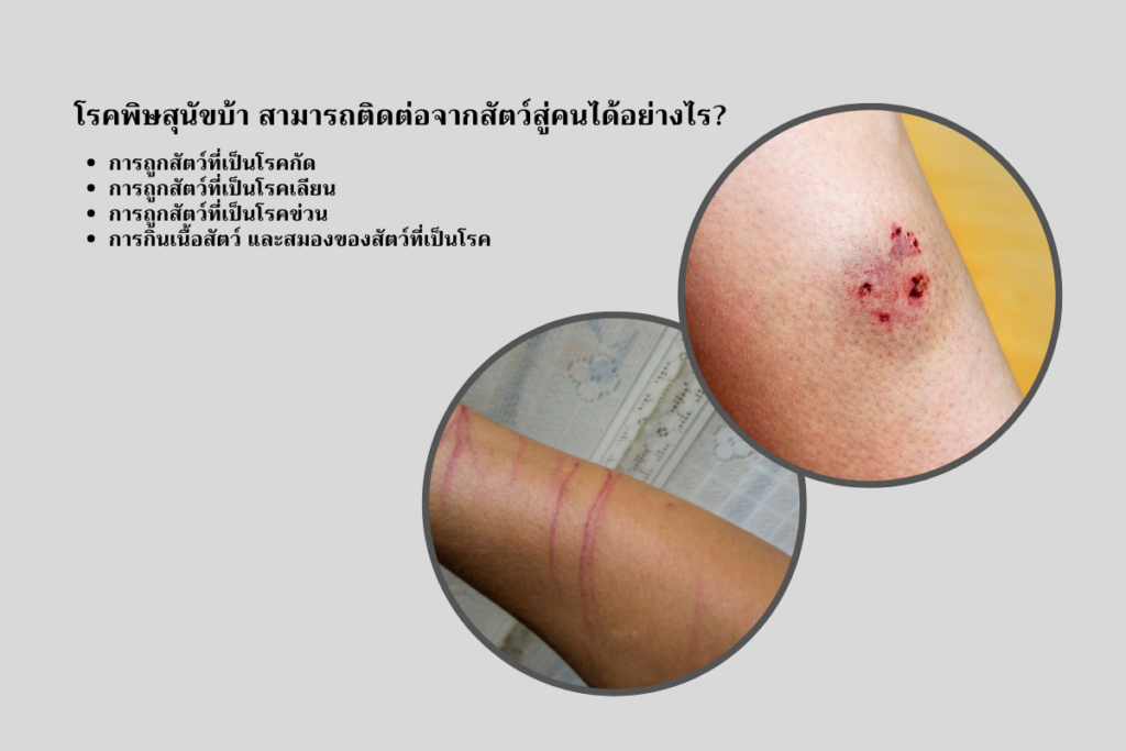 ถูกสัตว์ที่เป็นโรคกัด