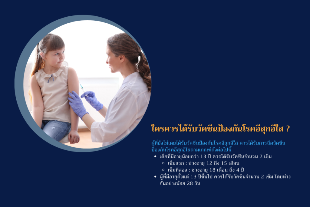 ใครควรได้รับวัคซีนป้องกันโรคอีสุกอีใส
