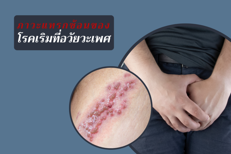 ภาวะแทรกซ้อนของโรคเริมที่อวัยวะเพศ