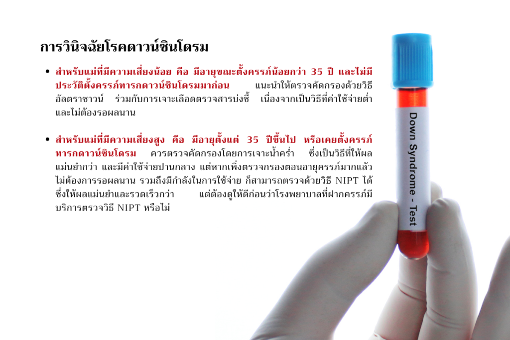 การวินิจฉัยโรคดาวน์ซินโดรม