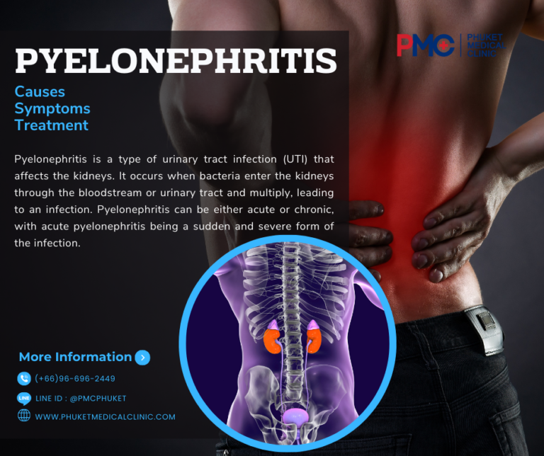 Pyelonephritis Causes, Symptoms and Treatment