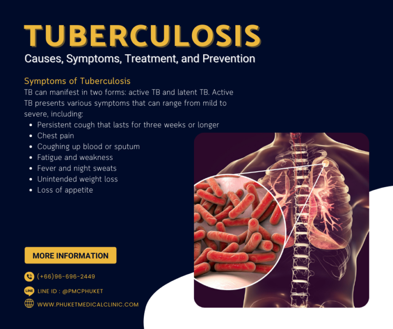 Tuberculosis Causes, Symptoms, Treatment, and Prevention