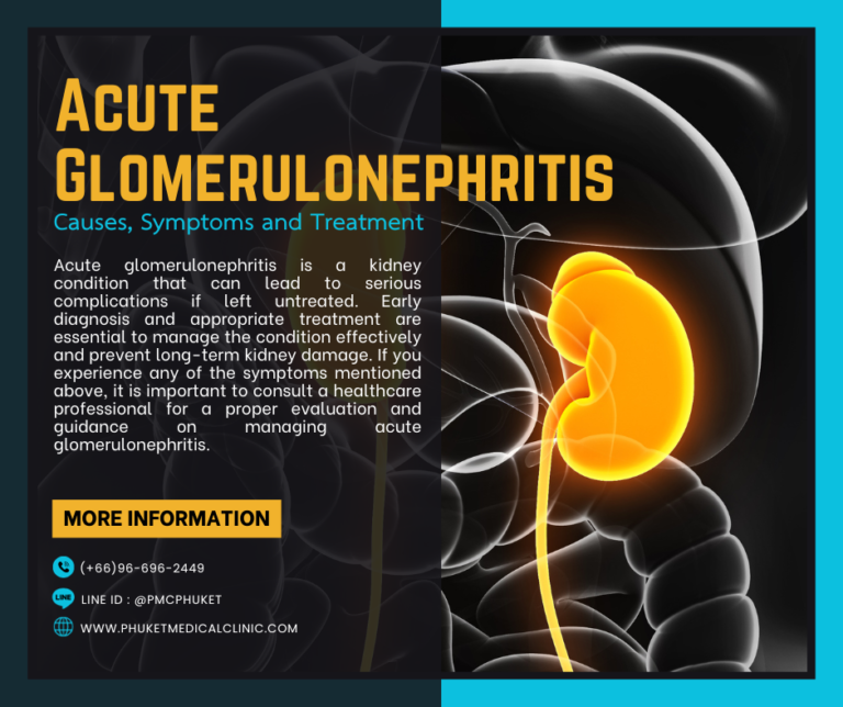Acute Glomerulonephritis Causes, Symptoms and Treatment