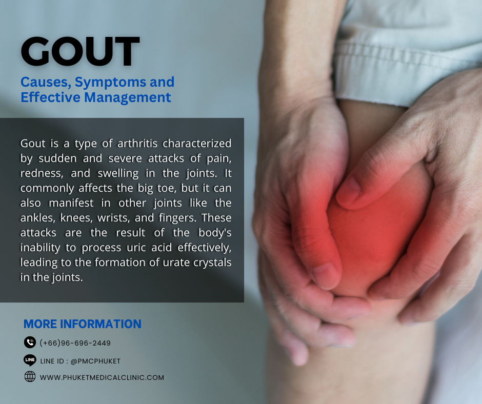 Gout Causes, Symptoms and Effective Management