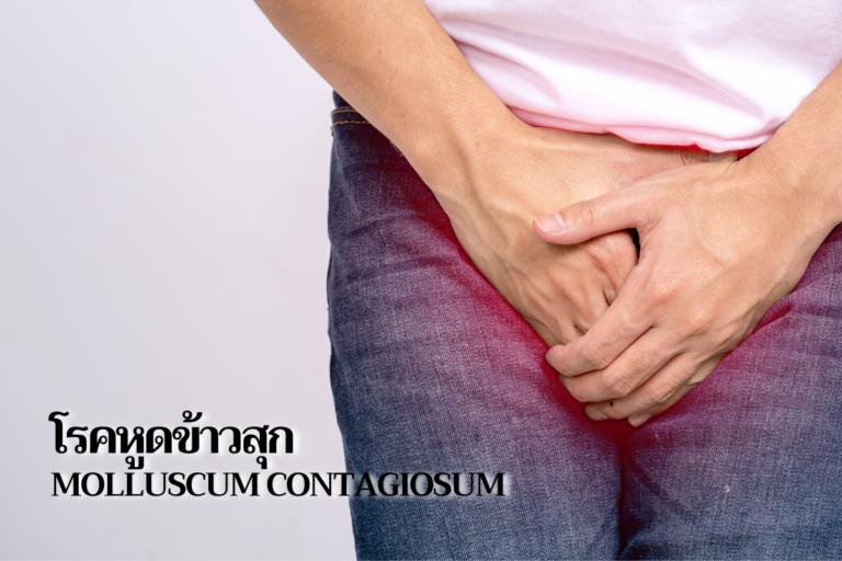 ตรวจเลือด HIV ภูเก็ต ที่ไหนดี? มาดูกันว่าคลินิกตรวจเลือด ภูเก็ตมีที่ไหนบ้าง