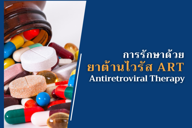การรักษาด้วยยาต้านไวรัส ART