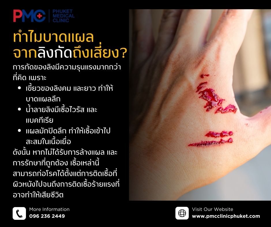 ทำไมบาดแผลจากลิงกัดถึงเสี่ยง