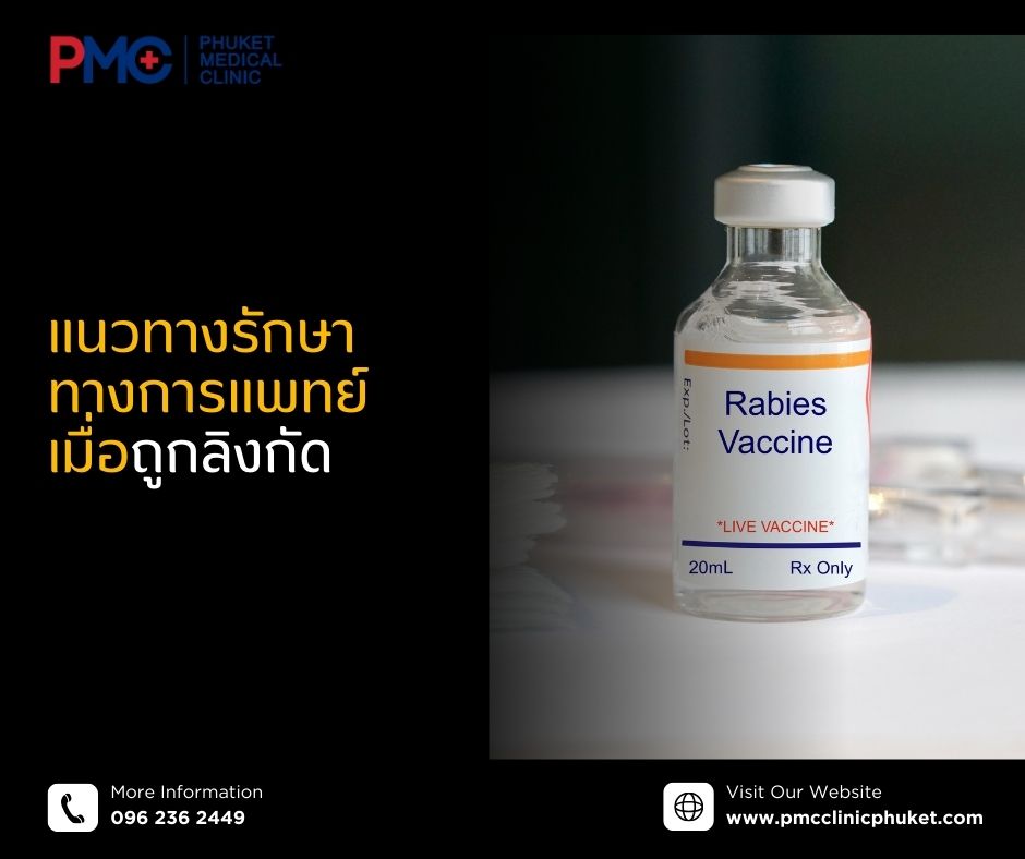 แนวทางรักษาทางการแพทย์เมื่อถูกลิงกัด
