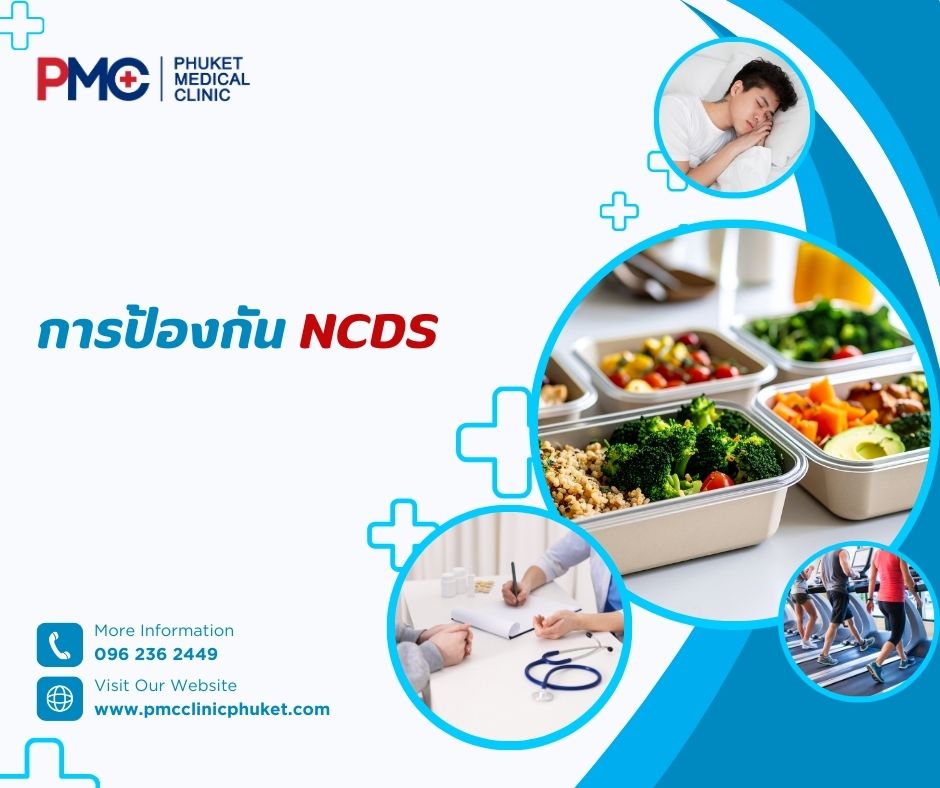 การป้องกัน NCDs